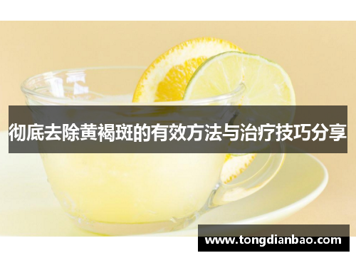 彻底去除黄褐斑的有效方法与治疗技巧分享